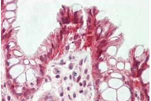 Human Colon: Formalin-Fixed, Paraffin-Embedded (FFPE)