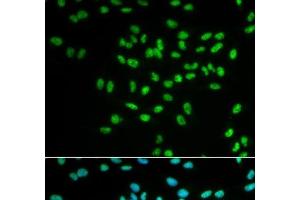 Immunofluorescence analysis of MCF-7 cells using FANCD2 Polyclonal Antibody (FANCD2 抗体)