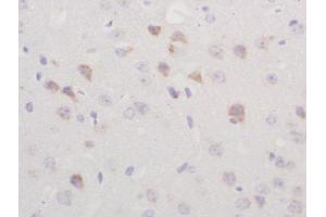 Formalin-fixed and paraffin embedded rat brain labeled with Rabbit Anti-TGM2 Polyclonal Antibody, Unconjugated  at 1:200 followed by conjugation to the secondary antibody and DAB staining (Transglutaminase 2 抗体  (AA 551-650))