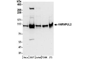 anti-Heterogeneous Nuclear Ribonucleoprotein U-Like 2 (HNRNPUL2) (AA 25-75) antibody