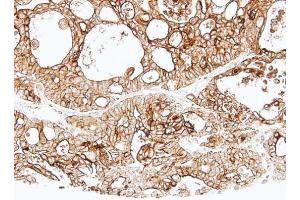IHC-P Image Immunohistochemical analysis of paraffin-embedded human Breast, using ALPPL2, antibody at 1:500 dilution. (ALPPL2 抗体  (Center))