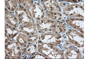 Immunohistochemistry (IHC) image for anti-Acetyl-CoA Acetyltransferase 2 (ACAT2) antibody (ABIN1496397) (ACAT2 抗体)