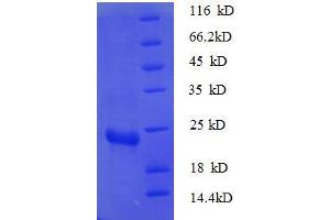 30S Ribosomal Protein S7 (RPSG2) (AA 2-179), (full length) protein (His tag)