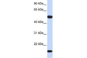 WB Suggested Anti-ADSSL1 Antibody Titration:  0.
