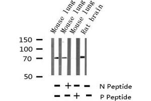 Western blot analysis of Phospho-DRP-2 (Thr514) expression in various lysates (DPYSL2 抗体  (pThr514))