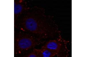 Immunofluorescence staining of methanol-fixed Hela cells using Paxillin(phospho-Tyr88) Antibody.