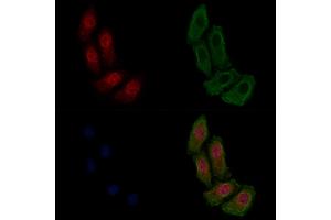 ABIN6255221 and ABIN6267478 staining HepG2 cells(4h of LPS treatment) by IF/ICC. (beta Catenin 抗体  (pSer33))