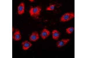 Immunofluorescent analysis of Beta-adducin staining in HeLa cells. (ADD2 抗体)