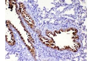 IHC testing of FFPE rat lung tissue with WFDC2 antibody at 1ug/ml. (WFDC2 抗体)