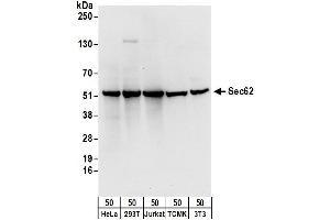 anti-Translocation Protein 1 (TLOC1) (AA 349-399) antibody