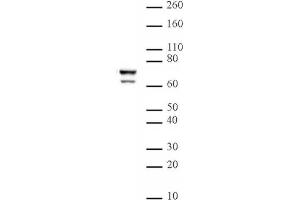 Lamin A/C mAb (Clone 3A6-4C11) tested by Western blot. (Lamin A/C 抗体  (AA 430-545))