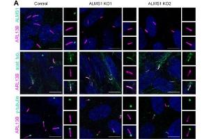 Immunofluorescence staining of wild-type and Tubb4ab KO respiratory MCC at P1 showing specific staining of Tubb4 (magenta), Arl13b( cat.