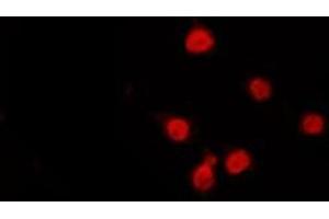 ABIN6272320 staining Hela by IF/ICC. (HDAC9 抗体  (C-Term))