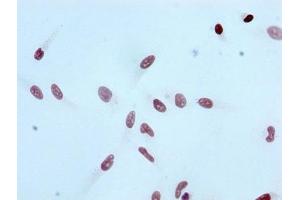 Immunocytochemistry analysis of ABIN7127269 diluted at 1:100 and staining in Hela cells performed on a Leica BondTM system. (Recombinant HIST1H3A 抗体  (H3K4ac))