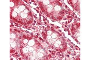 Immunohistochemistry (Paraffin-embedded Sections) (IHC (p)) image for anti-Zinc Finger, MYND-Type Containing 11 (ZMYND11) (AA 152-180), (N-Term) antibody (ABIN652533)