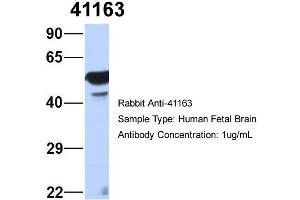 Western Blotting (WB) image for anti-Septin 11 (SEPT11) (N-Term) antibody (ABIN2787099)