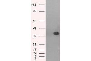 Western Blotting (WB) image for anti-Mitogen-Activated Protein Kinase 11 (MAPK11) antibody (ABIN1500806)