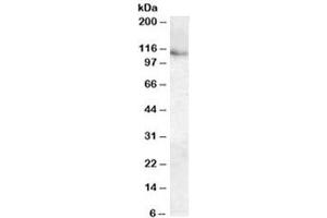 Western blot testing of human kidney lysate with ATP13A1 antibody at 0. (ATP13A1 抗体)