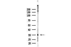 Western blot analysis of lysates from COLO205 cells(heat-shock,45 min treatment), using RNF167 Antibody at 1/1000 dilution.