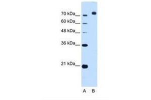 Image no. 1 for anti-Corin, Serine Peptidase (CORIN) (AA 881-930) antibody (ABIN321147)