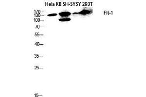 Western Blot (WB) analysis of HeLa, KB, SH-SY5Y, 293T lysis using Flt-1 antibody.