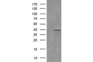 Image no. 6 for anti-Mitogen-Activated Protein Kinase Kinase 3 (MAP2K3) antibody (ABIN1499405)