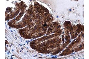 IHC-P Image E-Cadherin antibody detects E-Cadherin protein at cell membrane and cytoplasm in mouse prostate by immunohistochemical analysis. (E-cadherin 抗体)
