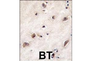 Formalin-fixed and paraffin-embedded human brain tissue reacted with GDF1 antibody (N-term), which was peroxidase-conjugated to the secondary antibody, followed by DAB staining. (GDF1 抗体  (N-Term))