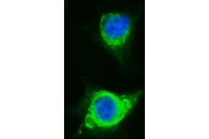 IF analysis of SORBS3 using anti-SORBS3 antibody (ABIN7603121).