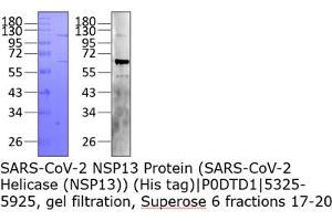 Western Blotting (WB) image for SARS-CoV-2 Helicase (NSP13) (HEL) protein (His tag) (ABIN6952696)