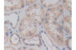 Immunohistochemistry (IHC) image for anti-Arginyl-tRNA Synthetase (RARS) (AA 1-146) antibody (ABIN7435304)