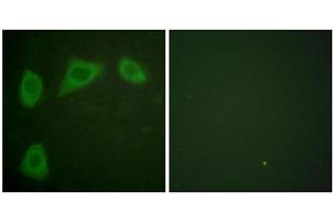 Immunofluorescence analysis of HuvEc cells, using Caveolin 1 antibody. (Caveolin-1 抗体  (C-Term))