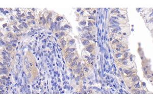 Immunohistochemistry (IHC) image for anti-B-Cell CLL/lymphoma 2 (BCL2) (AA 2-211) antibody (ABIN7426028)