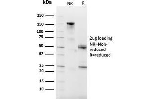 SDS-PAGE Analysis Purified CD10 Mouse Monoclonal Antibody (MME/2590). (MME 抗体  (AA 297-483))