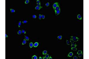 Immunofluorescent analysis of HepG2 cells using ABIN7172023 at dilution of 1:100 and Alexa Fluor 488-congugated AffiniPure Goat Anti-Rabbit IgG(H+L) (Peroxiredoxin 3 抗体  (AA 63-256))