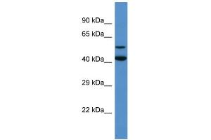 Western Blotting (WB) image for anti-Glutamate Decarboxylase-Like 1 (GADL1) (Middle Region) antibody (ABIN2774262) (GADL1 抗体  (Middle Region))