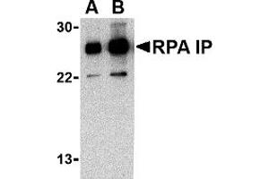 Western Blotting (WB) image for anti-RPA Interacting Protein (RPAIN) (C-Term) antibody (ABIN1030628) (RPAIN 抗体  (C-Term))