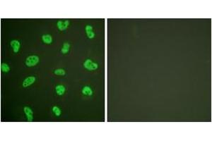 Immunofluorescence analysis of HeLa cells, using DNA-PK Antibody. (PRKDC 抗体  (AA 4061-4110))