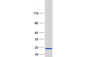 Validation with Western Blot