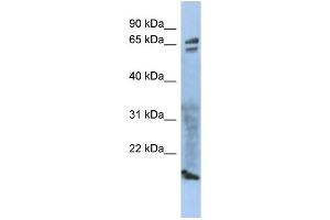 WB Suggested Anti-ZP1 Antibody Titration: 0. (ZP1 抗体  (Middle Region))