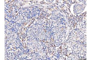 IHC analysis of Acid Phosphatase/ACP5 using anti-Acid Phosphatase/ACP5 antibody (ABIN7601574).