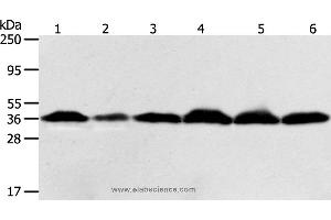 Western blot analysis of Hela cell and human liver cancer tissue, Raji, Jurkat, 293T and PC3 cell, using APEX1 Polyclonal Antibody at dilution of 1:450 (APEX1 抗体)