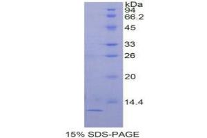SDS-PAGE analysis of Human TGFa Protein. (TGFA 蛋白)
