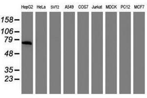 Image no. 2 for anti-alpha-Fetoprotein (AFP) antibody (ABIN1496491) (alpha Fetoprotein 抗体)
