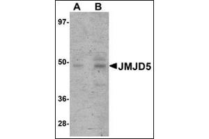 Western blot analysis of JMJD5 in human liver tissue lysate with this product at (A) 1 and (B) 2 μg/ml. (JMJD5 抗体  (C-Term))