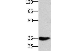 Western Blot analysis of Mouse muscle tissue using HOXA11 Polyclonal Antibody at dilution of 1:350 (Homeobox A11 抗体)