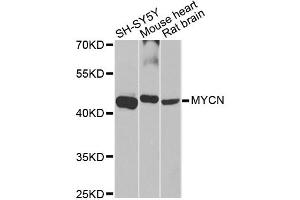 Western blot analysis of extracts of various cell lines, using MYCN antibody (ABIN5970179) at 1/1000 dilution. (MYCN 抗体)
