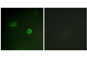 Immunofluorescence analysis of COS7 cells, using p90 RSK (Phospho-Thr573) antibody. (RPS6KA3 抗体  (pThr573))