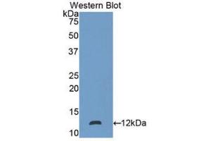 Western Blotting (WB) image for anti-S100 Calcium Binding Protein P (S100P) (AA 1-95) antibody (ABIN3205546) (S100P 抗体  (AA 1-95))