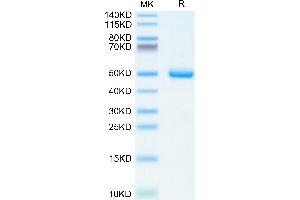 BAMBI Protein (AA 27-152) (Fc Tag)